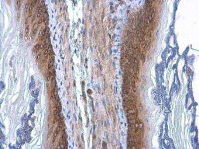 <b>Genetic Strategies Validation. </b>Immunohistochemistry-Paraffin: Coatomer Subunit Delta Antibody (189) [NBP2-43773] - Coatomer Subunit Delta Antibody (189) detects Coatomer Subunit Delta protein at cytoplasm by immunohistochemical analysis. Sample: Paraffin-embedded mouse esophagus. Coatomer Subunit Delta stained by Coatomer Subunit Delta Antibody (189) diluted at 1:200. Antigen Retrieval: Citrate buffer, pH 6.0, 15 min.