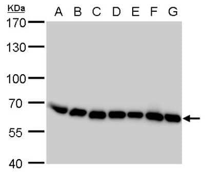 Western Blot: Coatomer Subunit Delta Antibody (189) [NBP2-43773] - Analysis of A. 30 ug Neuro2A whole cell lysate/extract B. 30 ug GL261 whole cell lysate/extract C. 30 ug C8D30 whole cell lysate/extract D. 30 ug NIH-3T3 whole cell lysate/extract E. 30 ug BCL-1 whole cell lysate/extract F. 30 ug Raw 264.7 whole cell lysate/extract G. 30 ug C2Cl2 whole cell lysate/extract 7.5 % SDS-PAGE COPD antibody [189] dilution: 1:5000