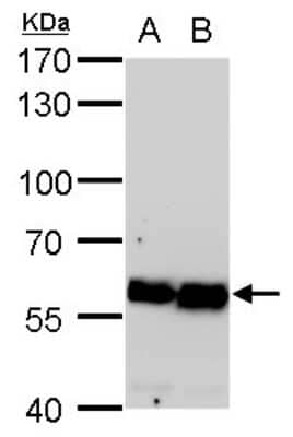 Western Blot: Coatomer Subunit Delta Antibody (189) [NBP2-43773] - Analysis of A. 30 ug PC-12 whole cell lysate/extract B. 30 ug Rat2 whole cell lysate/extract 7.5 % SDS-PAGE COPD antibody [189] dilution: 1:5000