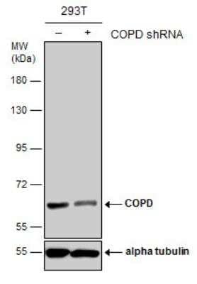 Western Blot: Coatomer Subunit Delta Antibody (189) [NBP2-43773] - Non-transfected (-) and transfected (+) 293T whole cell extracts (30 ug) were separated by 7.5% SDS-PAGE, and the membrane was blotted with COPD antibody [189].