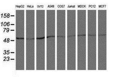 Western Blot: Coatomer Subunit Delta Antibody (6A6) [NBP2-01791] - Analysis of extracts (35ug) from 9 different cell lines by using anti-Coatomer Subunit Delta monoclonal antibody (HepG2: human; HeLa: human; SVT2: mouse; A549: human; COS7: monkey; Jurkat: human; MDCK: canine; PC12: rat; MCF7: human).