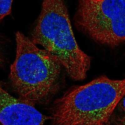 Immunocytochemistry/Immunofluorescence: Coatomer Subunit Delta Antibody [NBP2-55235] - Staining of human cell line U-2 OS shows localization to vesicles.