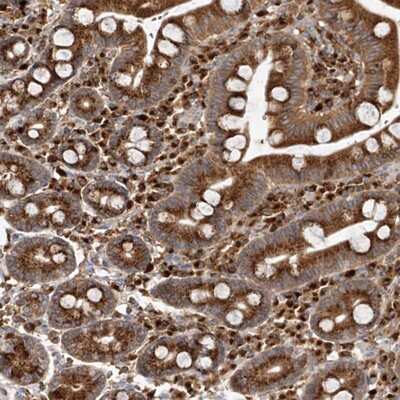 Immunohistochemistry-Paraffin: Coatomer Subunit Delta Antibody [NBP1-85515] - Staining of human duodenum shows strong cytoplasmic positivity in glandular cells.