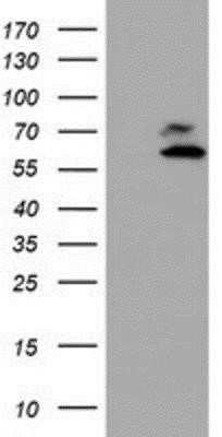 Western Blot: Coatomer Subunit Delta Antibody (OTI6A6) - Azide and BSA Free [NBP2-70203] - HEK293T cells were transfected with the pCMV6-ENTRY control (Left lane) or pCMV6-ENTRY Coatomer Subunit Delta (Right lane) cDNA for 48 hrs and lysed. Equivalent amounts of cell lysates (5 ug per lane) were separated by SDS-PAGE and immunoblotted with anti