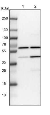 Western Blot: Coatomer Subunit Delta Antibody [NBP1-85515] - Lane 1: NIH-3T3 cell lysate (Mouse embryonic fibroblast cells)Lane 2: NBT-II cell lysate (Rat Wistar bladder tumour cells)