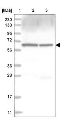 Western Blot: Coatomer Subunit Delta Antibody [NBP1-85515] - Lane 1: Marker [kDa] 230, 130, 95, 72, 56, 36, 28, 17, 11Lane 2: Human cell line RT-4Lane 3: Human cell line U-251MG sp