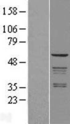 Western Blot: Coatomer Subunit Delta Overexpression Lysate (Adult Normal) [NBL1-07646] Left-Empty vector transfected control cell lysate (HEK293 cell lysate); Right -Over-expression Lysate for Coatomer Subunit Delta.