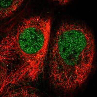 Immunocytochemistry/Immunofluorescence: Cofilin 2 Antibody [NBP2-38544] - Staining of human cell line A-431 shows localization to nucleoplasm. Antibody staining is shown in green.