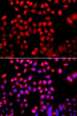 Immunocytochemistry/Immunofluorescence: Cofilin 2 Antibody [NBP2-92683] - Immunofluorescence analysis of A549 cells using Cofilin 2 antibody (NBP2-92683). Blue: DAPI for nuclear staining.