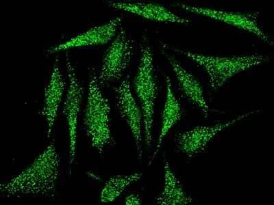 Immunocytochemistry/Immunofluorescence: Cofilin 2 Antibody [NBP2-98909] - Immunofluorescence staining of Cofilin 2 in HeLa cells. Cells were fixed with 4% PFA, blocked with 10% serum, and incubated with rabbit anti-human Cofilin 2 polyclonal antibody (1:1000) at 4C overnight. Then cells were stained with the Alexa Fluor(R)488-conjugated Goat Anti-rabbit IgG Secondary antibody (green).Positive staining was localized to cytoplasm and nucleus.