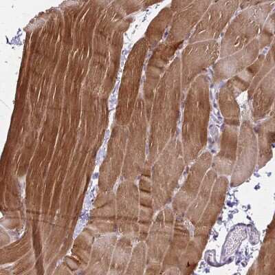 Immunohistochemistry-Paraffin: Cofilin 2 Antibody [NBP2-38544] - Staining of human skeletal muscle shows high expression.