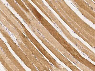 Immunohistochemistry-Paraffin: Cofilin 2 Antibody [NBP2-98909] - Immunochemical staining of human Cofilin 2 in human skeletal muscle with rabbit polyclonal antibody (1:1000, formalin-fixed paraffin embedded sections).