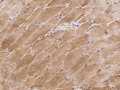 Immunohistochemistry-Paraffin Cofilin 2 Antibody