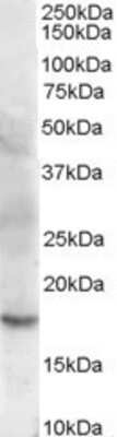 Western Blot: Cofilin 2 Antibody [NB600-800] - Analysis of Human Muscle lysate (35 ug protein in RIPA buffer). Primary incubation was 1 hour. Detected by chemiluminescence.