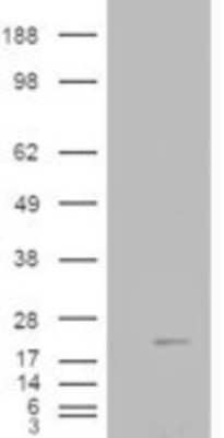Western Blot: Cofilin 2 Antibody [NB600-800] - HEK293 overexpressing Human Muscle Cofilin 2 and probed with (mock transfection in first lane).