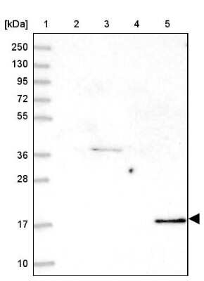 Western Blot: Cofilin 2 Antibody [NBP2-38544] - Lane 1: Marker  [kDa] 250, 130, 95, 72, 55, 36, 28, 17, 10.  Lane 2: Human cell line RT-4.  Lane 3: Human cell line U-251MG.  Lane 4: Human Plasma.  Lane 5: Human liver tissue