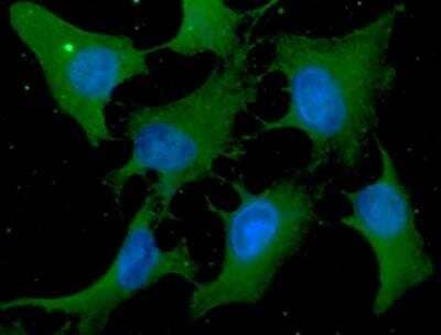 Immunocytochemistry/Immunofluorescence: Cofilin Antibody (1C1) [NBP1-21044] - Analysis of Cofilin1 in HeLa cells line, stained with DAPI (Blue) for nucleus staining and monoclonal anti-human Cofilin1 antibody (1:100) with goat anti-mouse IgG-Alexa fluor 488 conjugate (Green).