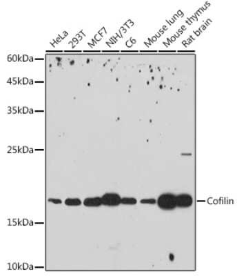 Western Blot: Cofilin Antibody (4M1Z9) [NBP3-16141] - Western blot analysis of extracts of various cell lines, using Cofilin antibody (NBP3-16141) at 1:1000 dilution. Secondary antibody: HRP Goat Anti-Rabbit IgG (H+L) at 1:10000 dilution. Lysates/proteins: 25ug per lane. Blocking buffer: 3% nonfat dry milk in TBST. Detection: ECL Basic Kit. Exposure time: 180s.