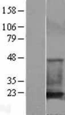 Western Blot: Cofilin Overexpression Lysate (Adult Normal) [NBL1-09126] Left-Empty vector transfected control cell lysate (HEK293 cell lysate); Right -Over-expression Lysate for Cofilin.