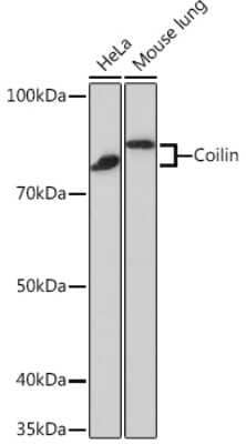 Western Blot: Coilin Antibody (7Z4K1) [NBP3-16196] - Western blot analysis of extracts of various cell lines, using Coilin Rabbit mAb (NBP3-16196) at 1:1000 dilution. Secondary antibody: HRP Goat Anti-Rabbit IgG (H+L) at 1:10000 dilution. Lysates/proteins: 25ug per lane. Blocking buffer: 3% nonfat dry milk in TBST. Detection: ECL Basic Kit. Exposure time: 90s.