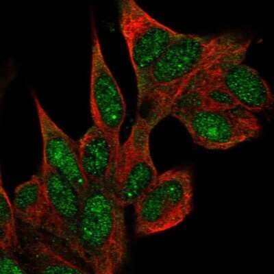 Immunocytochemistry/Immunofluorescence: Coilin Antibody [NBP2-57887] - Staining of human cell line SH-SY5Y shows localization to nucleus & nuclear bodies.