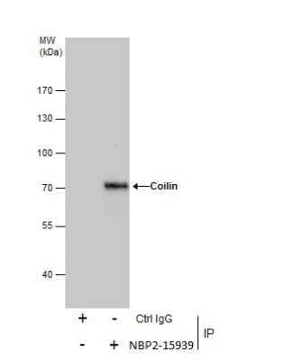 Immunoprecipitation: Coilin Antibody [NBP2-15939] - Immunoprecipitation of Coilin protein from 293T whole cell extracts using 5 ug of Coilin antibody.  Western blot analysis was performed using Coilin antibody.  EasyBlot anti-Rabbit IgG was used as a secondary reagent.