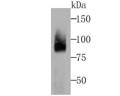 Western Blot: Coilin Antibody (JU44-08) [NBP2-75443] - Analysis of Coilin on rat kidney tissue lysates using anti-Coilin at 1/500 dilution.