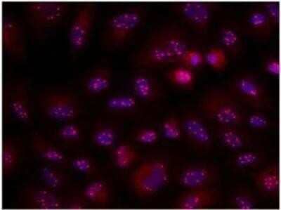 Immunocytochemistry/Immunofluorescence: Coilin Antibody (Pdelta) [NB600-1275] - HeLa cells were fixed and permeabilized with 4% paraformaldehyde followed by 0.5% Triton X-100. Fixed cells were stained with 10 ug/mL Monoclonal Anti-Coilin Clone: pdelta (NB600-1275). The antibody was developed using Goat Anti-Mouse IgG, Cy3 conjugate. Cells were counterstained with DAPI (blue) to stain nuclei.