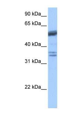 Western Blot: Coilin Antibody [NBP1-54669] - Jurkat cell lysate, concentration 0.2-1 ug/ml.