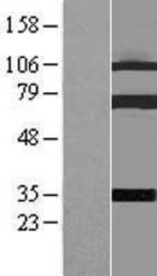 Western Blot: Coilin Overexpression Lysate (Adult Normal) [NBL1-09347] Left-Empty vector transfected control cell lysate (HEK293 cell lysate); Right -Over-expression Lysate for Coilin.