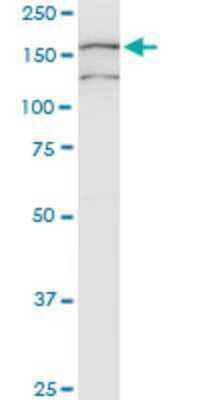 Western Blot: Colec12 Antibody (4A7) [H00081035-M01] - COLEC12 monoclonal antibody (M01), clone 4A7. Analysis of COLEC12 expression in JAR.