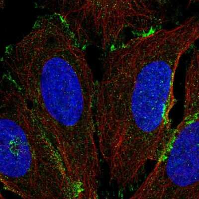 Immunocytochemistry/Immunofluorescence: Colec12 Antibody [NBP2-58826] - Staining of human cell line U-2 OS shows localization to the Golgi apparatus, cell junctions & vesicles.