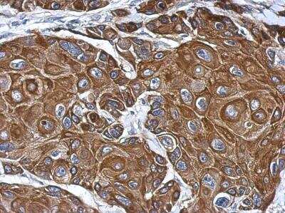 Immunohistochemistry-Paraffin: Colec12 Antibody [NBP2-15944] - Analysis of paraffin-embedded Cal27 xenograft, using antibody at 1:500 dilution.