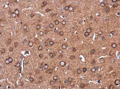 Immunohistochemistry-Paraffin: Colec12 Antibody [NBP2-15944] - Rat brain. Colec12 antibody [N2C1], Internal diluted at 1:500.