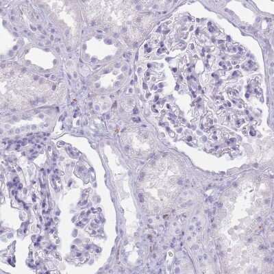 Immunohistochemistry-Paraffin: Colec12 Antibody [NBP2-33508] - Staining of human kidney shows low expression as expected.