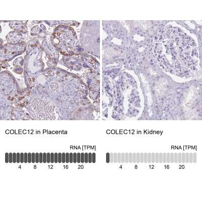 Immunohistochemistry-Paraffin: CL-P1/COLEC12 Antibody [NBP2-33508] - Colec12 Antibody [NBP2-33508] - Staining in human placenta and kidney tissues using anti-COLEC12 antibody. Corresponding COLEC12 RNA-seq data are presented for the same tissues.