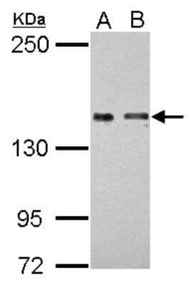 Western Blot: Colec12 Antibody [NBP2-15944] - Sample (30 ug of whole cell lysate) A: Raji  B: K562 5% SDS PAGE diluted at 1:2000 