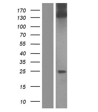 Western Blot Collagen I alpha 1 Overexpression Lysate