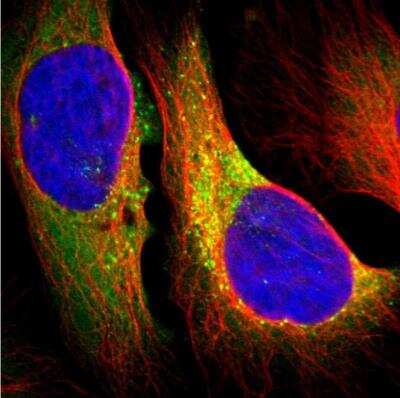 Immunocytochemistry/Immunofluorescence: Collagen I alpha 1 Antibody [NBP1-82488] - Staining of human cell line U-2 OS shows localization to cytosol & vesicles. Antibody staining is shown in green.