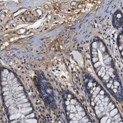 Immunohistochemistry-Paraffin: Collagen I alpha 1 Antibody [NBP1-82488] - Staining of human colon shows moderate cytoplasmic positivity in stromal cells.