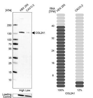 Western Blot: Collagen II Antibody [NBP2-55511] - Analysis in human cell line HEK 293 and human cell line CACO-2.