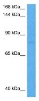 Western Blot: Collagen IV alpha5 Antibody [NBP3-10797] - Western blot analysis of Collagen IV alpha5 in Human ACHN Whole Cell lysates. Antibody dilution at 1ug/ml