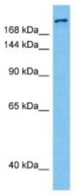 Western Blot: Collagen IV alpha5 Antibody [NBP3-10862] - Western blot analysis of Collagen IV alpha5 in Human K562 Whole Cell lysates. Antibody dilution at 1ug/ml