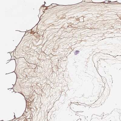 Immunohistochemistry-Paraffin: Collagen IX alpha 2 Antibody [NBP2-69005] - Immunohistochemical staining of human eye shows positivity in vitreous of the eye.