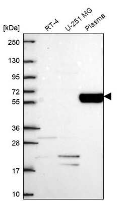 Western Blot Collagen IX alpha 2 Antibody