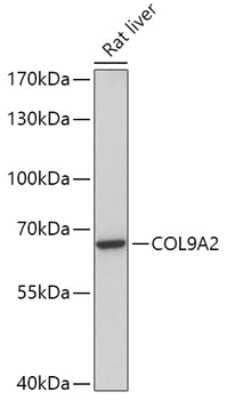 Western Blot Collagen IX alpha 2 Antibody - Azide and BSA Free