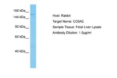 Western Blot: Collagen V alpha 2 Antibody [NBP2-83978] - Host: Rabbit. Target Name: CO5A2. Sample Type: Fetal Liver lysates. Antibody Dilution: 1.0ug/ml