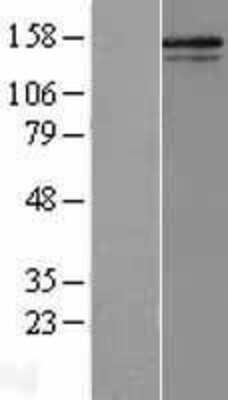 Western Blot: Collagen V alpha 2 Overexpression Lysate (Adult Normal) [NBL1-09355] Left-Empty vector transfected control cell lysate (HEK293 cell lysate); Right -Over-expression Lysate for Collagen V alpha 2.