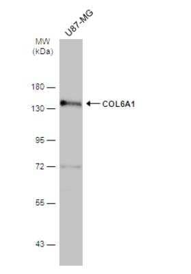 Western Blot: Collagen VI alpha 1 Antibody [NBP2-15947] - Whole cell extract (30 ug) was separated by 7.5% SDS-PAGE, and the membrane was blotted with COL6A1 antibody [C1C2], Internal diluted at 1:500. The HRP-conjugated anti-rabbit IgG antibody (NBP2-19301) was used to detect the primary antibody.