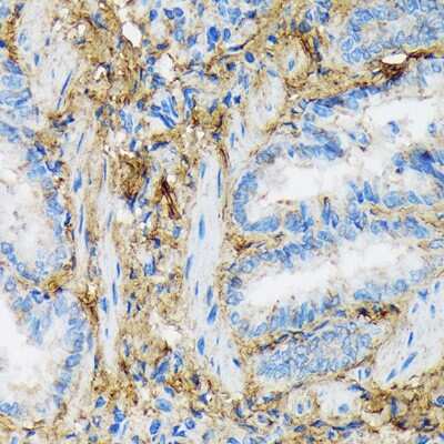 Immunohistochemistry-Paraffin: Collagen VI alpha 1 Antibody (7J1P4) [NBP3-16869] - Immunohistochemistry of paraffin-embedded rat lung using Collagen VI alpha 1 Rabbit mAb (NBP3-16869) at dilution of 1:100 (40x lens).Perform microwave antigen retrieval with 10 mM Tris/EDTA buffer pH 9.0 before commencing with IHC staining protocol.